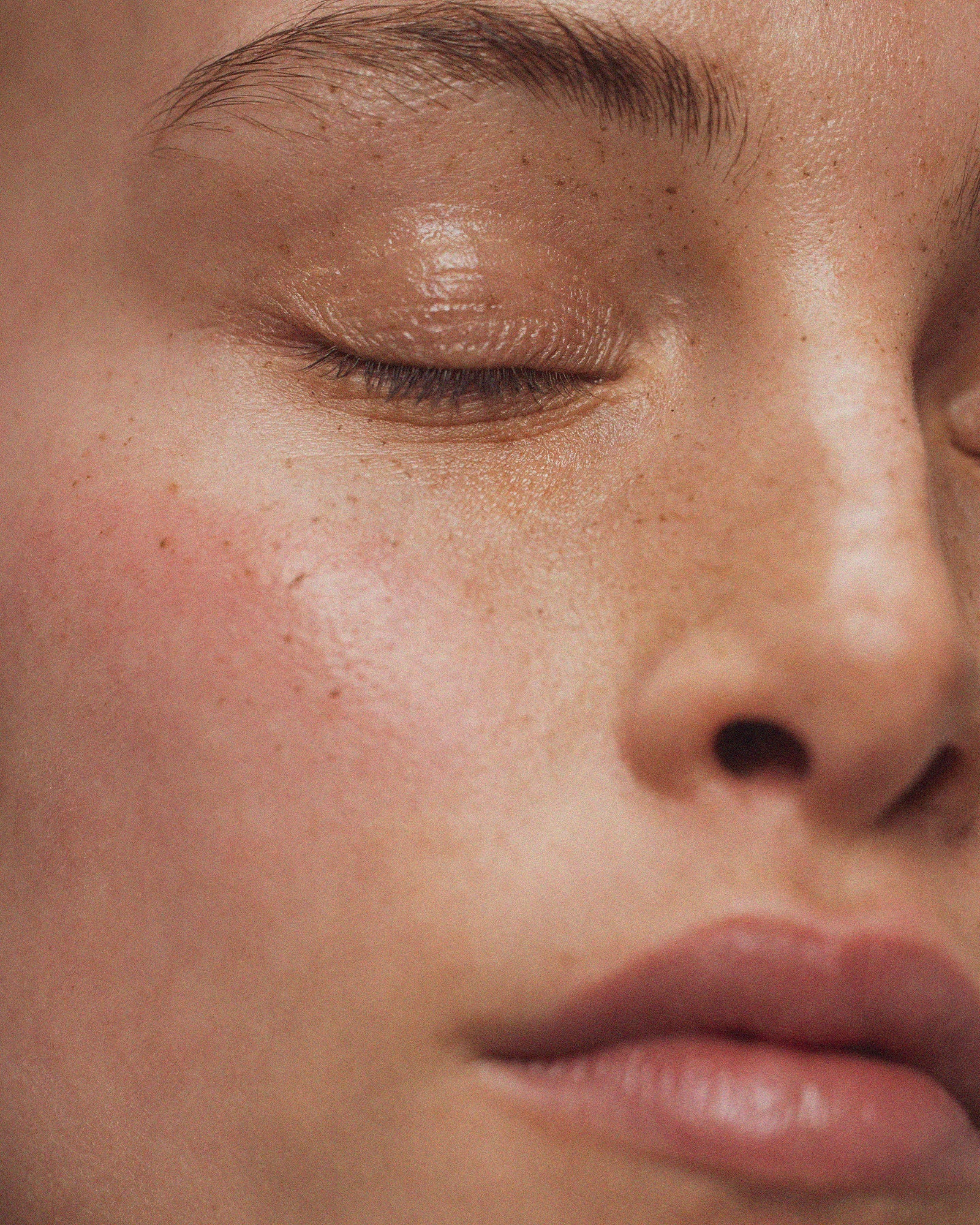 3 common myths about dry skin – debunked